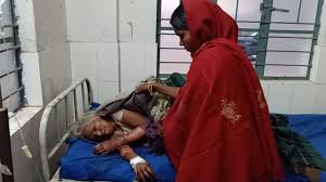 अलाव तापने के दौरान वृद्ध महिला जलकर हुई बुरी तरह जख्मी